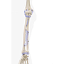Skelett „Otto“ mit Bandapparat 