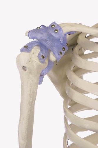 Skelett „Otto“ mit Bandapparat 