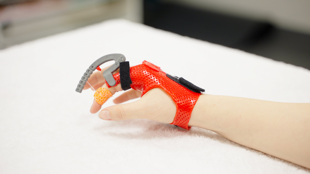Orfit Dynasyst Isoforce Schienenausleger