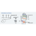 Dynamische Finger Extensionsschiene (Carpener) 