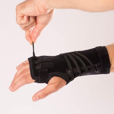 Manex Ulnar