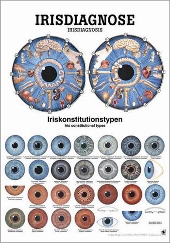 Iris-Diagnose
