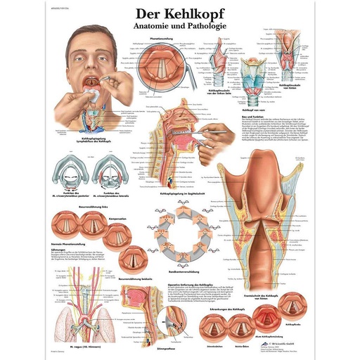 [Art. Nr. SCIE1001336] Der Kehlkopf